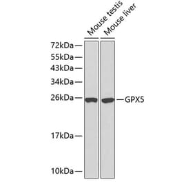 Western Blot - Anti-GPX5 Antibody (A13045) - Antibodies.com