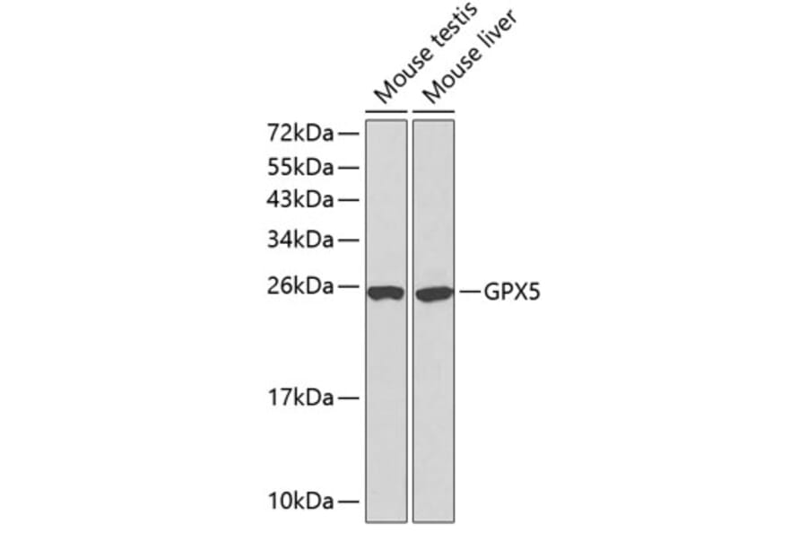 Western Blot - Anti-GPX5 Antibody (A13045) - Antibodies.com