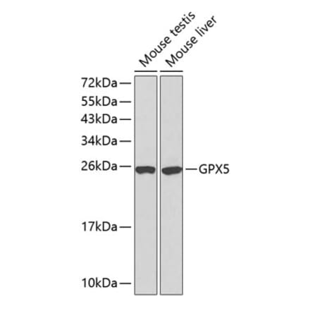 Western Blot - Anti-GPX5 Antibody (A13045) - Antibodies.com