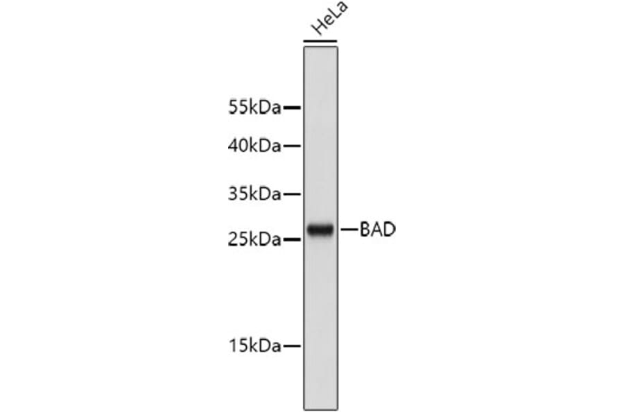 Western Blot - Anti-BAD Antibody (A10753) - Antibodies.com