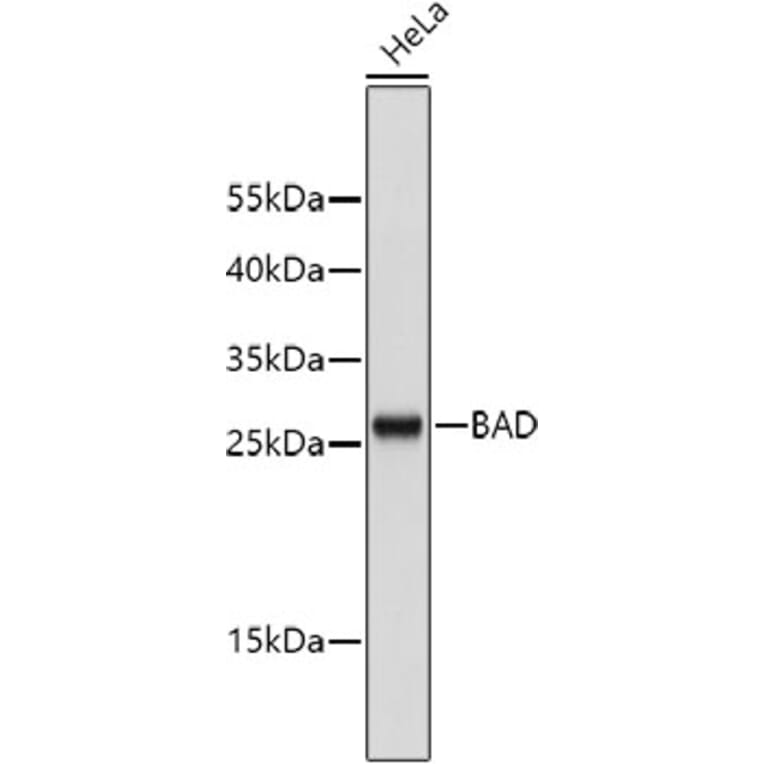 Western Blot - Anti-BAD Antibody (A10753) - Antibodies.com