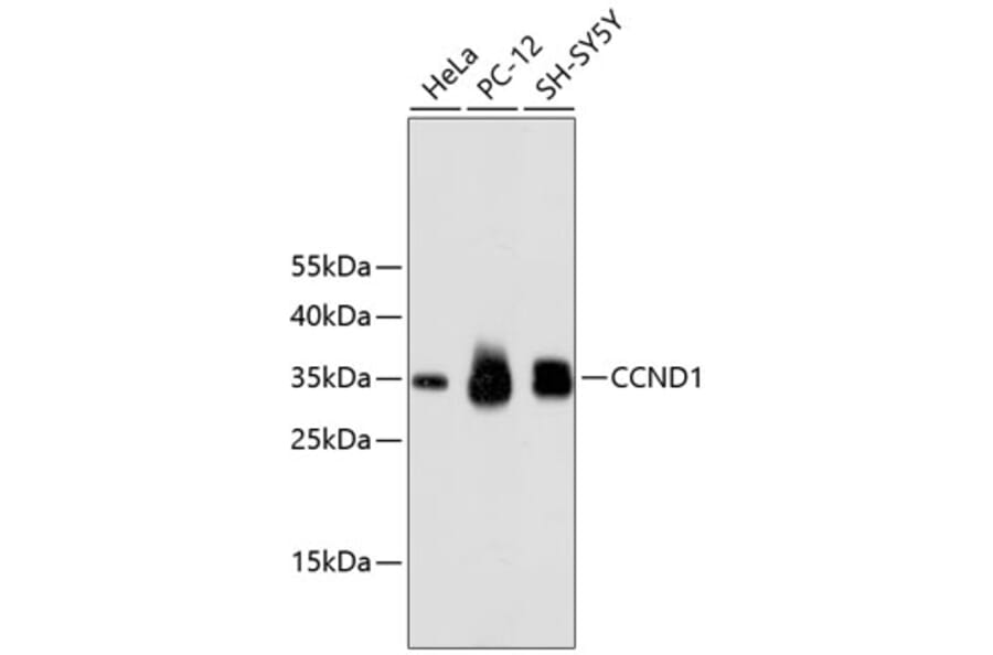 Western Blot - Anti-CCND1 Antibody (A10757) - Antibodies.com