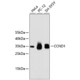 Western Blot - Anti-CCND1 Antibody (A10757) - Antibodies.com