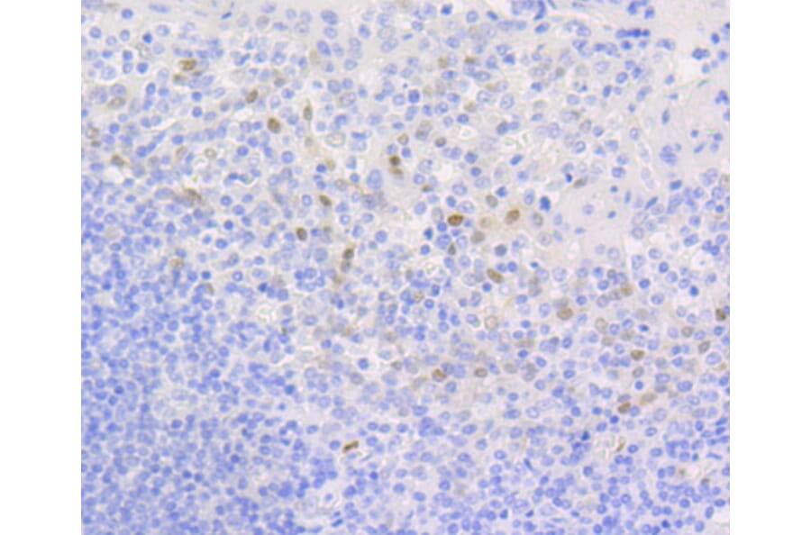 Immunohistochemistry - Anti-CCND1 Antibody (A10757) - Antibodies.com