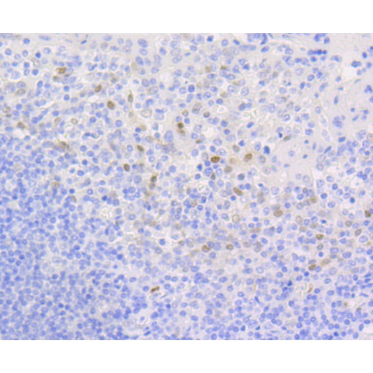 Immunohistochemistry - Anti-CCND1 Antibody (A10757) - Antibodies.com