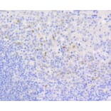 Immunohistochemistry - Anti-CCND1 Antibody (A10757) - Antibodies.com