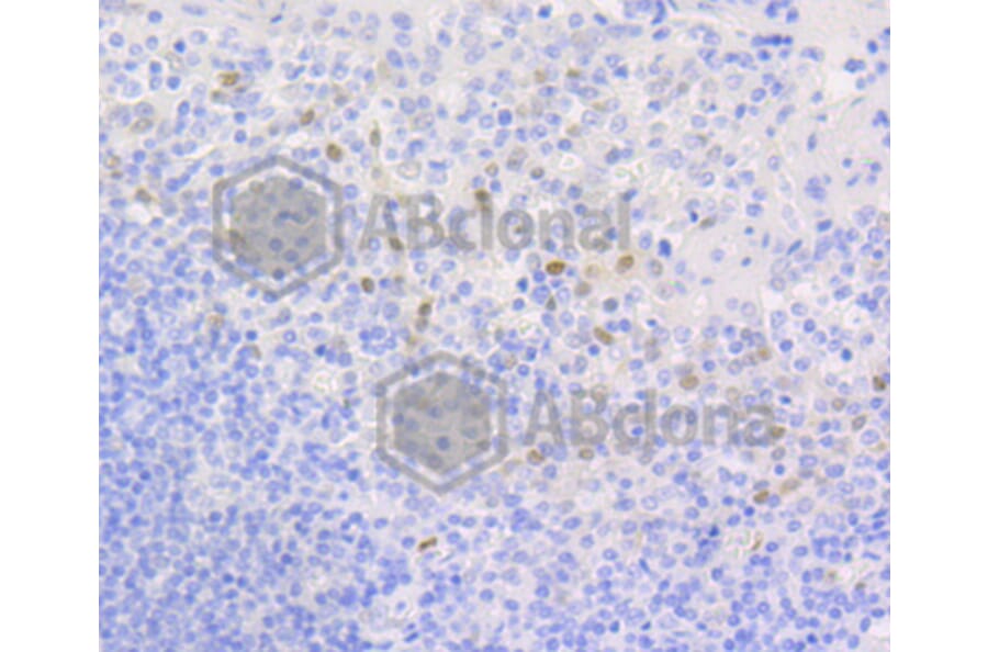 Immunohistochemistry - Anti-CCND1 Antibody (A10757) - Antibodies.com