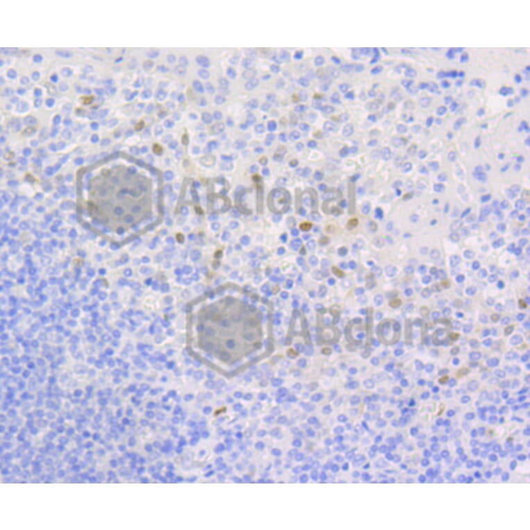 Immunohistochemistry - Anti-CCND1 Antibody (A10757) - Antibodies.com