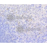 Immunohistochemistry - Anti-CCND1 Antibody (A10757) - Antibodies.com