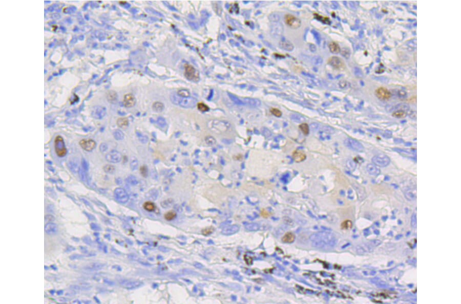 Immunohistochemistry - Anti-CCND1 Antibody (A10757) - Antibodies.com