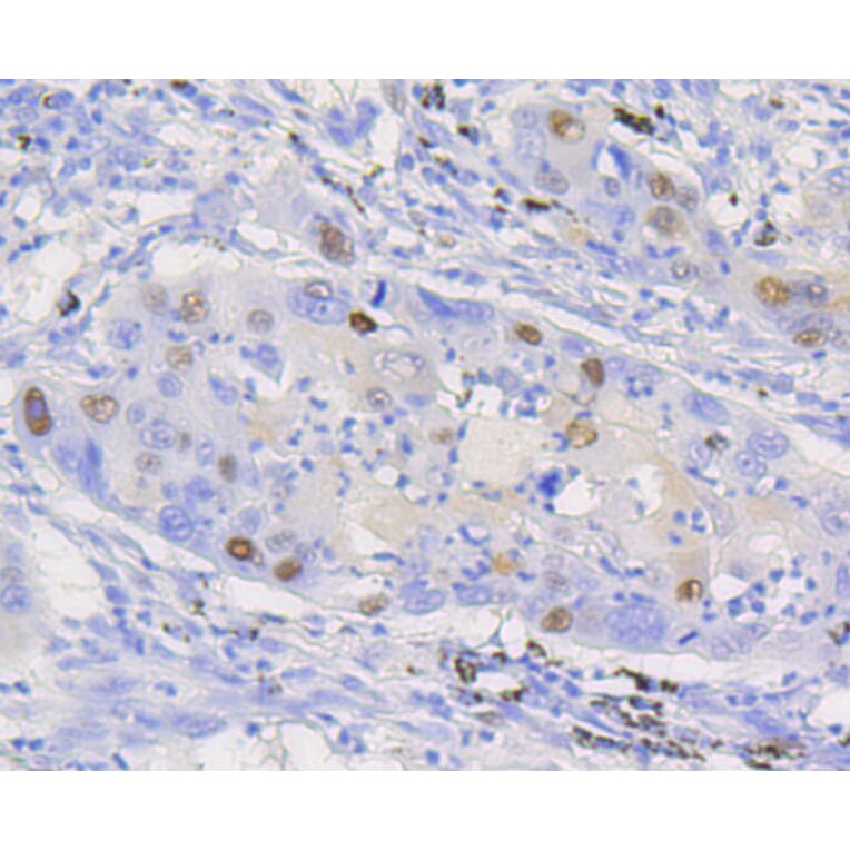 Immunohistochemistry - Anti-CCND1 Antibody (A10757) - Antibodies.com