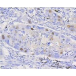 Immunohistochemistry - Anti-CCND1 Antibody (A10757) - Antibodies.com