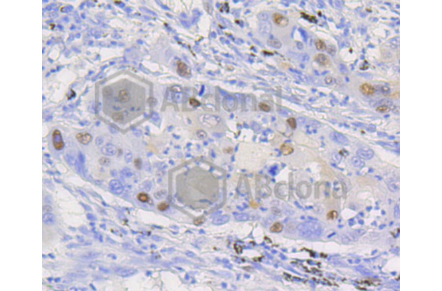 Immunofluorescence - Anti-CCND1 Antibody (A10757) - Antibodies.com