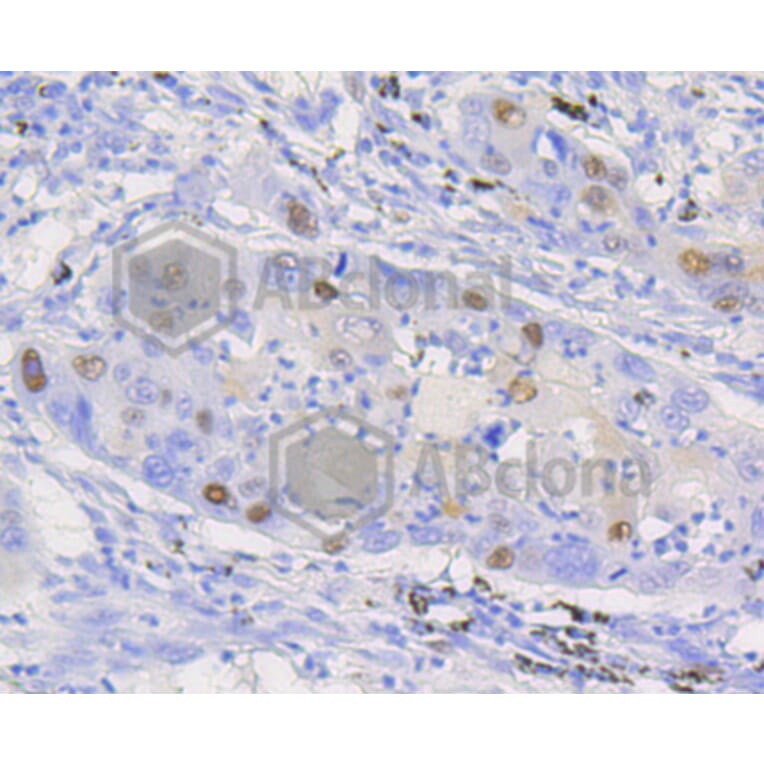 Immunofluorescence - Anti-CCND1 Antibody (A10757) - Antibodies.com