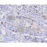 Immunofluorescence - Anti-CCND1 Antibody (A10757) - Antibodies.com