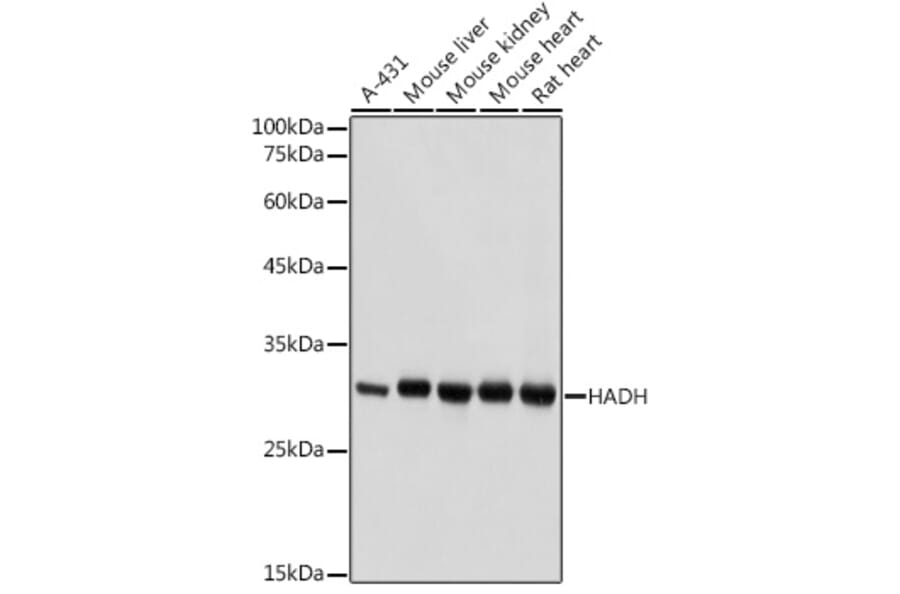 Western Blot - Anti-HADH Antibody (A13049) - Antibodies.com