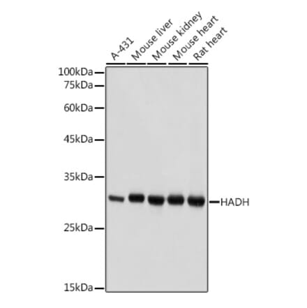Western Blot - Anti-HADH Antibody (A13049) - Antibodies.com
