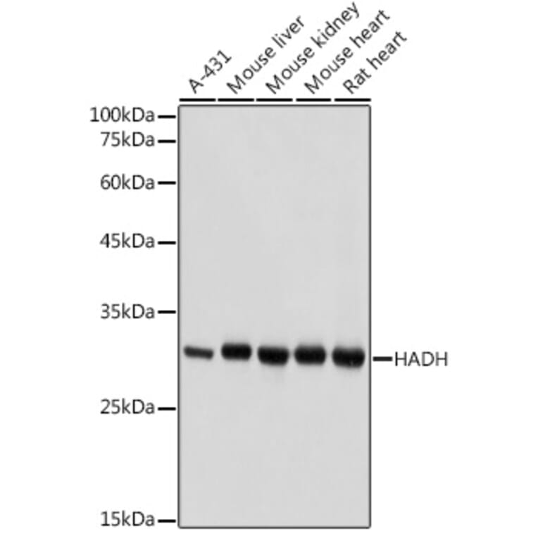 Western Blot - Anti-HADH Antibody (A13049) - Antibodies.com