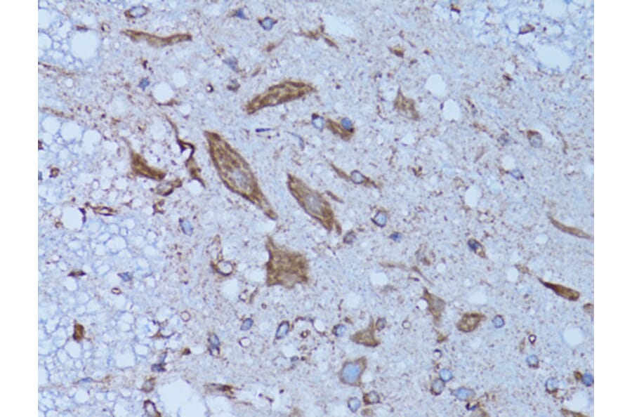 Immunohistochemistry - Anti-HADH Antibody (A13049) - Antibodies.com