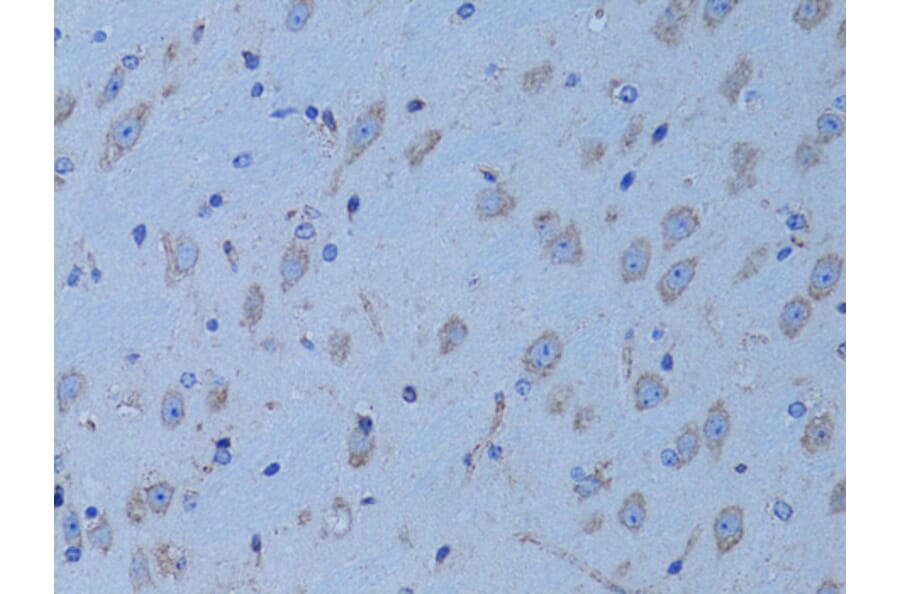 Immunohistochemistry - Anti-HADH Antibody (A13049) - Antibodies.com