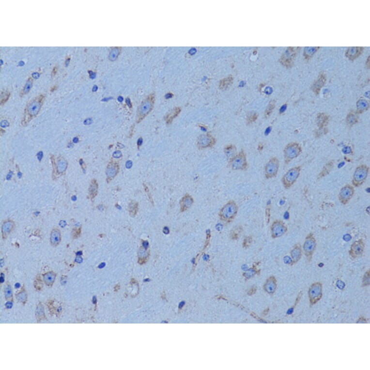 Immunohistochemistry - Anti-HADH Antibody (A13049) - Antibodies.com