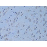 Immunohistochemistry - Anti-HADH Antibody (A13049) - Antibodies.com
