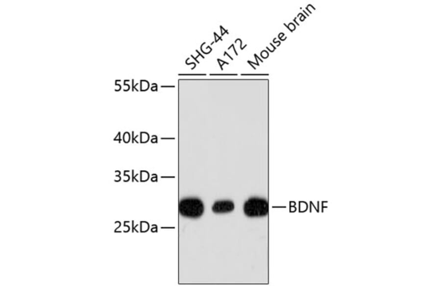 Western Blot - Anti-BDNF Antibody (A10760) - Antibodies.com
