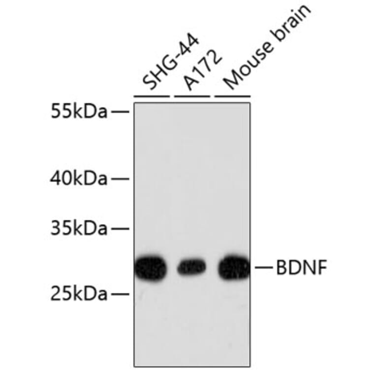 Western Blot - Anti-BDNF Antibody (A10760) - Antibodies.com