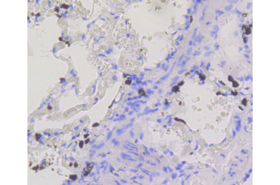 Immunohistochemistry - Anti-BDNF Antibody (A10760) - Antibodies.com
