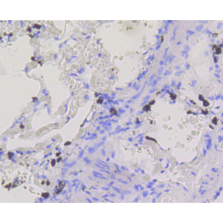 Immunohistochemistry - Anti-BDNF Antibody (A10760) - Antibodies.com