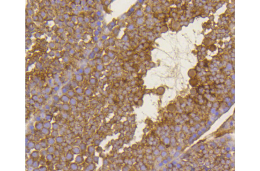 Immunohistochemistry - Anti-BDNF Antibody (A10760) - Antibodies.com