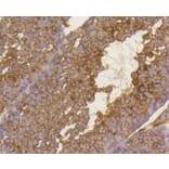 Immunohistochemistry - Anti-BDNF Antibody (A10760) - Antibodies.com