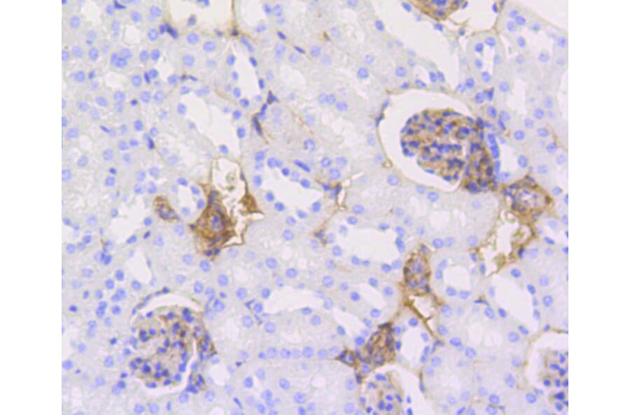 Immunohistochemistry - Anti-CALD1 Antibody (A10768) - Antibodies.com