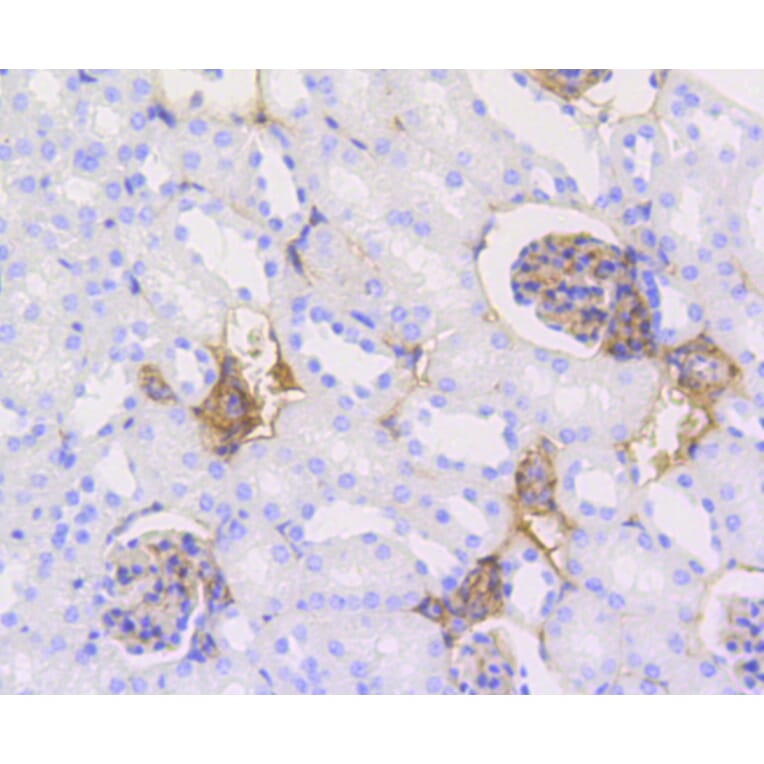 Immunohistochemistry - Anti-CALD1 Antibody (A10768) - Antibodies.com