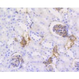 Immunohistochemistry - Anti-CALD1 Antibody (A10768) - Antibodies.com
