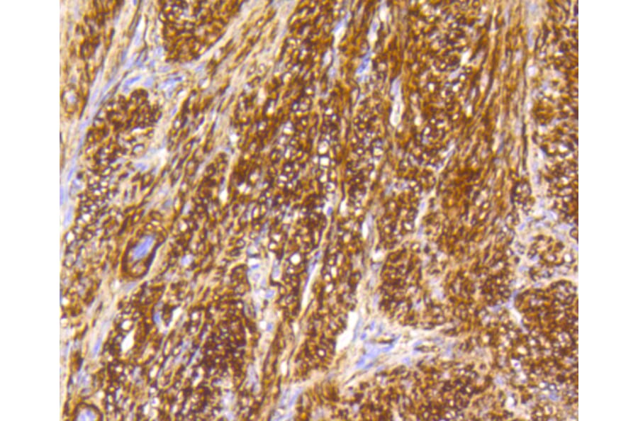 Immunohistochemistry - Anti-CALD1 Antibody (A10768) - Antibodies.com