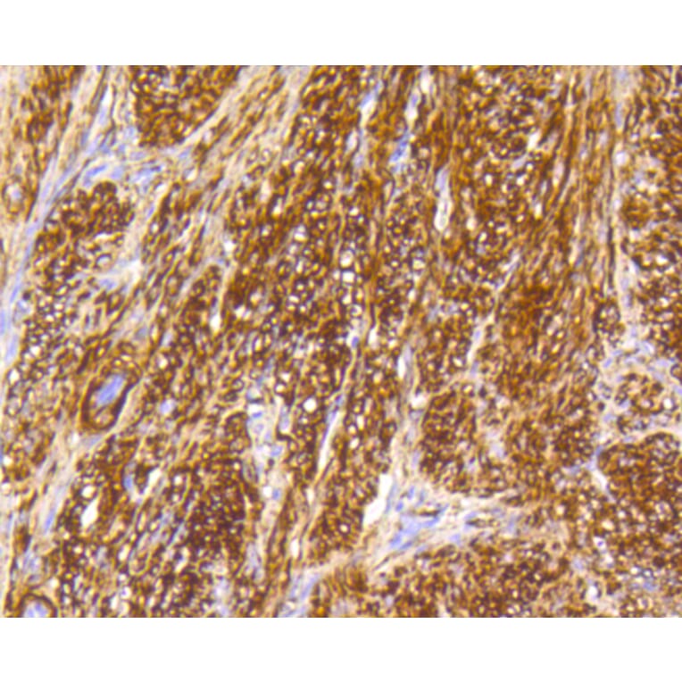 Immunohistochemistry - Anti-CALD1 Antibody (A10768) - Antibodies.com