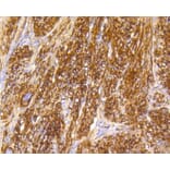 Immunohistochemistry - Anti-CALD1 Antibody (A10768) - Antibodies.com