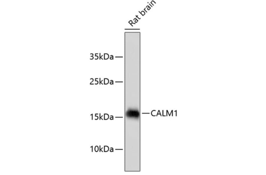 Western Blot - Anti-CALM1 Antibody (A10769) - Antibodies.com