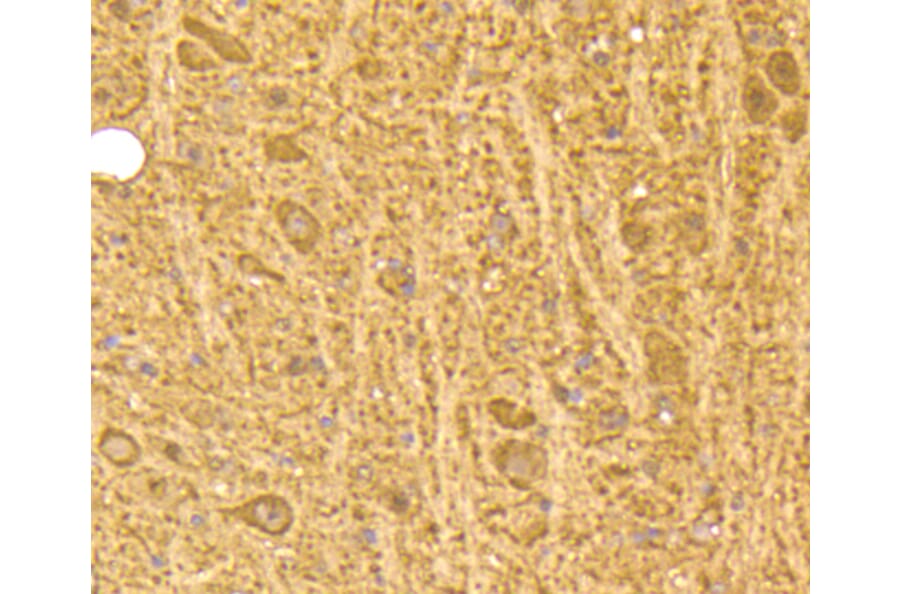 Immunohistochemistry - Anti-CALM1 Antibody (A10769) - Antibodies.com