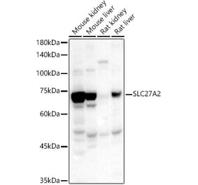 Western Blot - Anti-SLC27A2 Antibody (A13054) - Antibodies.com