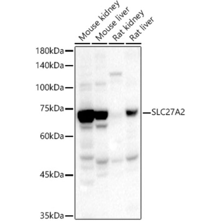 Western Blot - Anti-SLC27A2 Antibody (A13054) - Antibodies.com