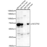 Western Blot - Anti-SLC27A2 Antibody (A13054) - Antibodies.com