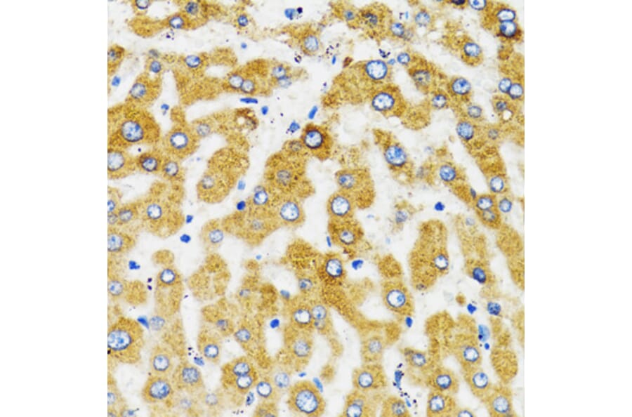 Immunohistochemistry - Anti-SLC27A2 Antibody (A13054) - Antibodies.com