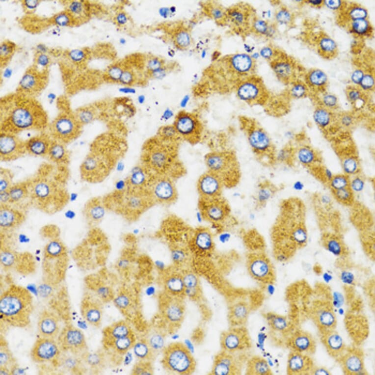 Immunohistochemistry - Anti-SLC27A2 Antibody (A13054) - Antibodies.com