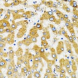 Immunohistochemistry - Anti-SLC27A2 Antibody (A13054) - Antibodies.com