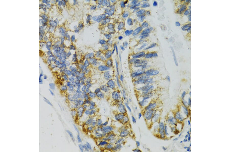Immunohistochemistry - Anti-SLC27A2 Antibody (A13054) - Antibodies.com