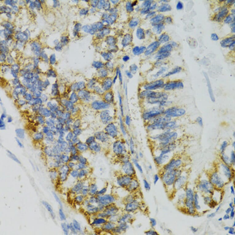 Immunohistochemistry - Anti-SLC27A2 Antibody (A13054) - Antibodies.com