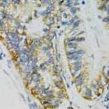 Immunohistochemistry - Anti-SLC27A2 Antibody (A13054) - Antibodies.com