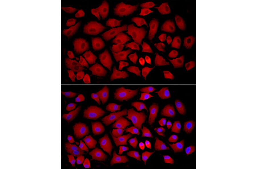 Immunofluorescence - Anti-SLC27A2 Antibody (A13054) - Antibodies.com